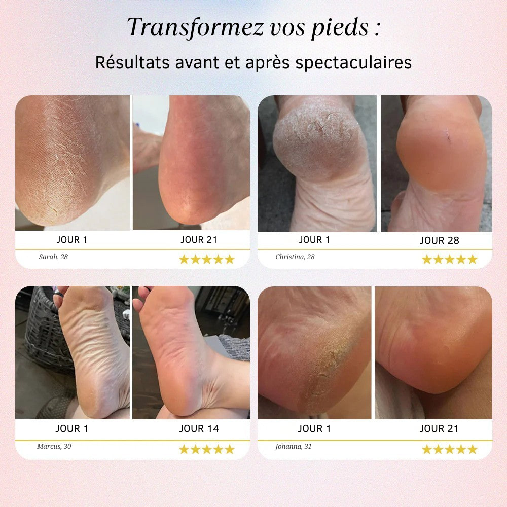 Cosylis Pro - Des pieds doux sans visites coûteuses en salon