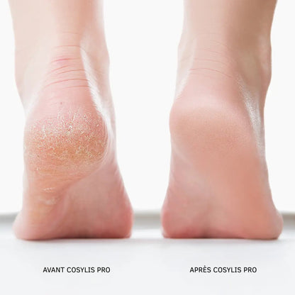Cosylis Pro - Des pieds doux sans visites coûteuses en salon