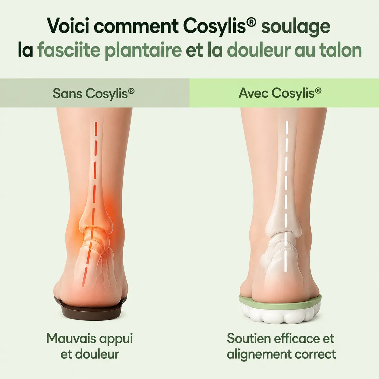 Semelles orthopédiques pour soulager les douleurs au talon et la fasciite plantaire.